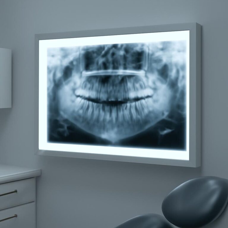 Contre-indications implant dentaire : radiographie panoramique au cabinet